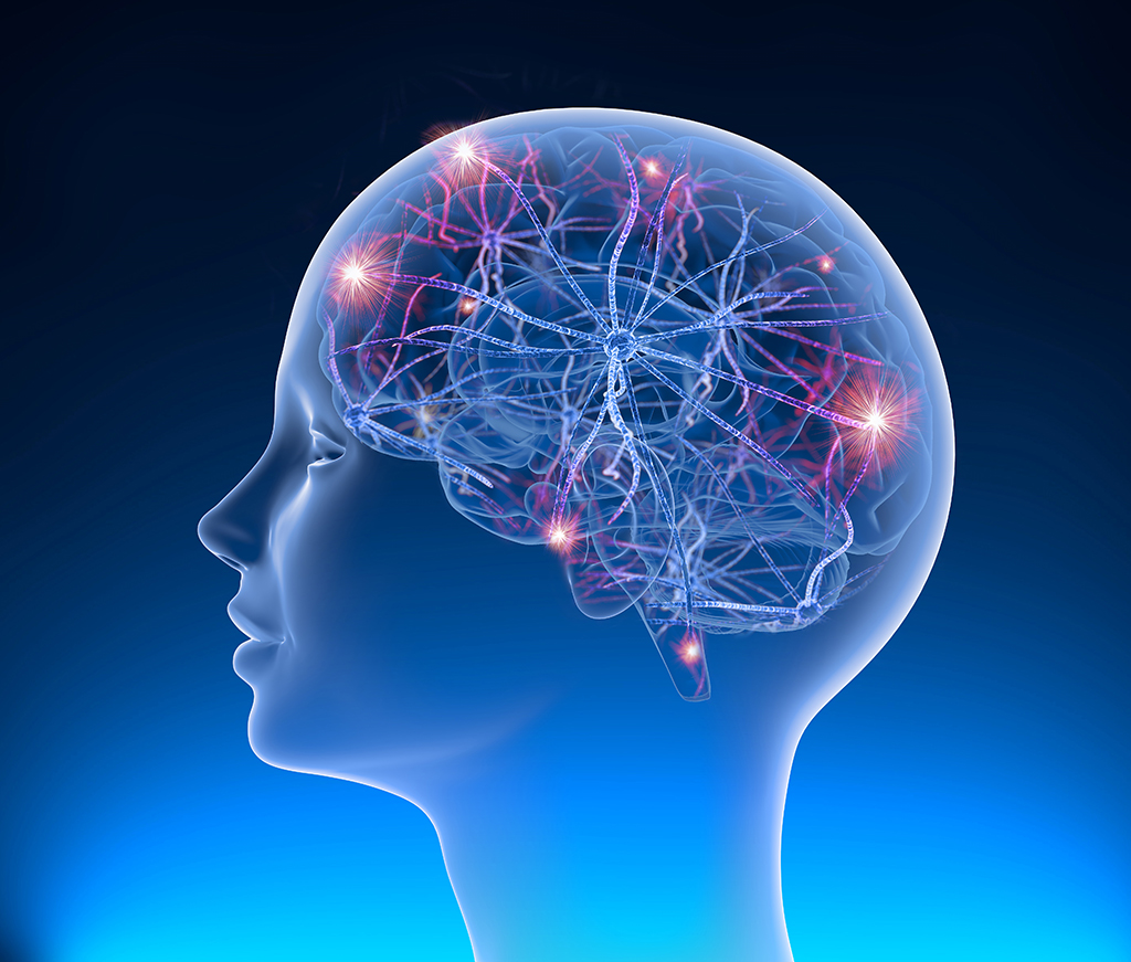 A diagram of electrical brain activity for someone with epilepsy.