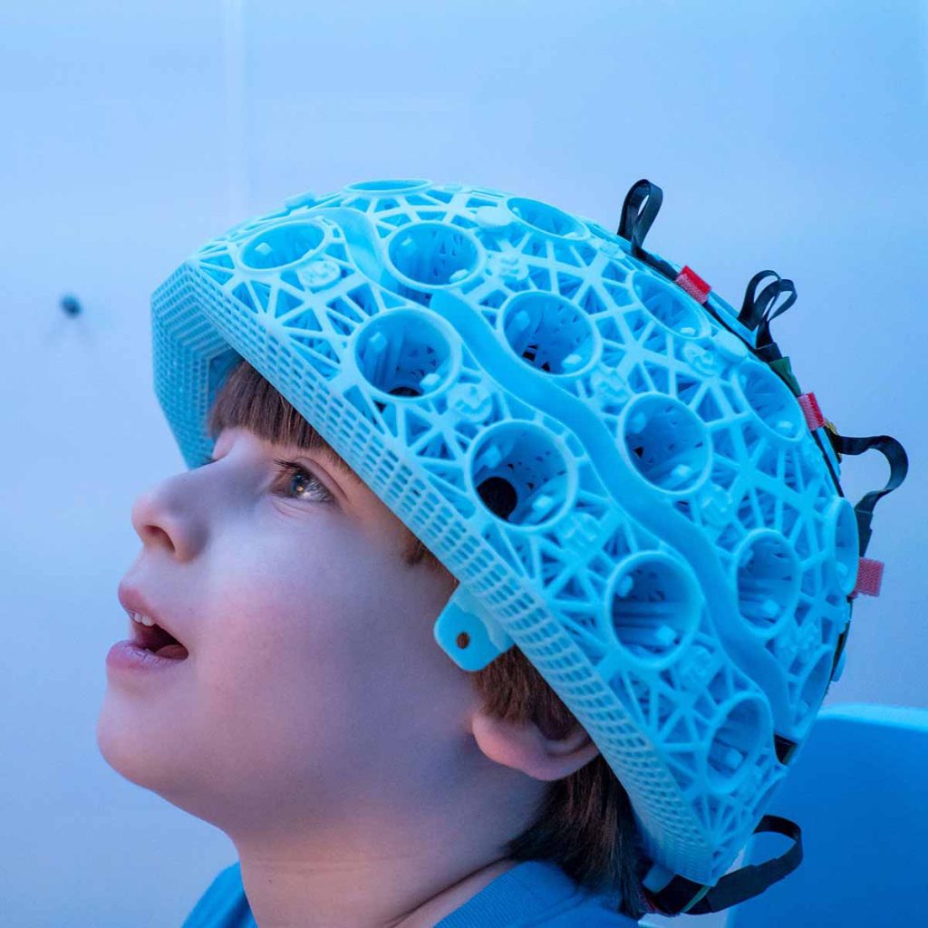 Wearable brain scanner developed at University of Nottingham