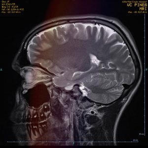 VC Pines' MRI album cover