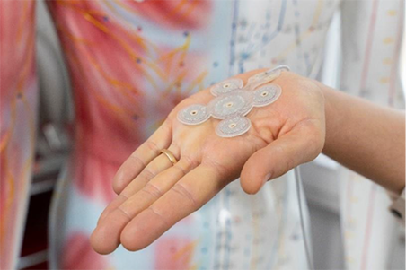 A New Option for Epilepsy Treatment: UK’s First EASEE® Implant A New Option for Epilepsy Treatment: UK’s First EASEE® Implant