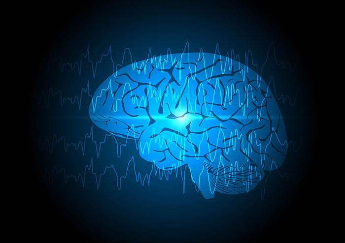 What do focal seizures feel like and recent research update What do focal seizures feel like and recent research update