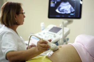 Baroness amos report on maternity care finds fragmented services, racism and women not being listened to. Female doctor doing an ultrasound scan on pregnant woman