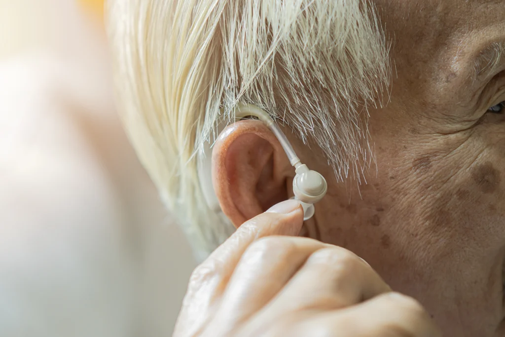 Hearing aids lower risk of dementia in people with epilepsy and hearing loss by 23% – study